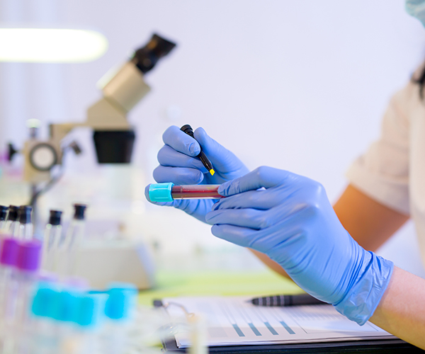 A scientist wearing a mask and gloves holds a vial of blood in a lab, empty vials and a microscope can be seen in the background.