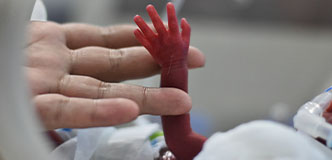 Adult hand holding preterm infant arm.