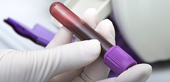 Vial filled with blood for testing.