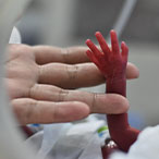 Adult human hand holding tiny preterm infant arm and hand.