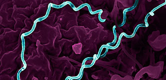 Spiral-shaped bacteria highlighted in teal against a purple background.