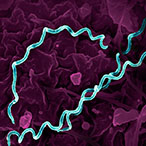 Spiral-shaped bacteria highlighted in teal against a purple background.