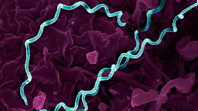 Spiral-shaped bacteria highlighted in teal against a purple background.