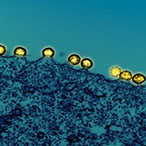 Colorized transmission electron micrograph of yellow HIV-1 particles budding and replicating from a dark blue H9 T cell.
