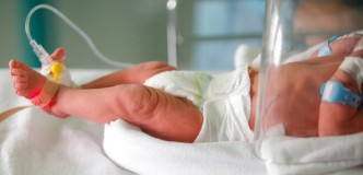 Un bebé acostado en una incubadora. El bebé tiene un pañal, dos pulseras médicas y un monitor de pie.
