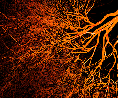 Vessels are colored orange against a black background. They start off with thicker branches on the top right and become more fibrous and narrow at the bottom left.
