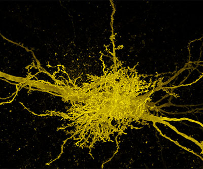 Microscopy image of yellow cells against a black background. The center junction contains many vessel-like projections. The axons of the two neurons are thicker and run from top left to bottom right.
