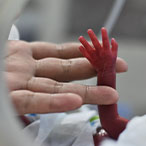 Adult hand holding a tiny preterm infant’s arm and hand.