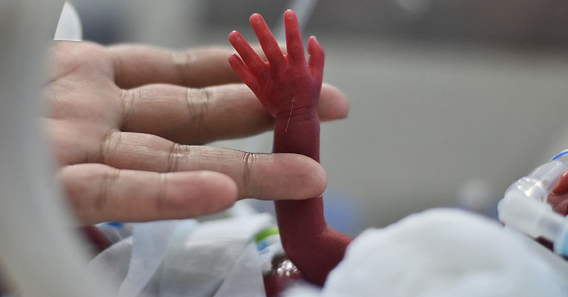 Adult hand holding a tiny preterm infant’s arm and hand.