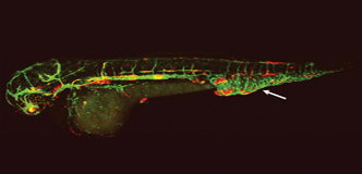 Un pez cebra con los vasos linfáticos y sanguíneos marcados con fluorescencia y una malformación vascular en la cola.