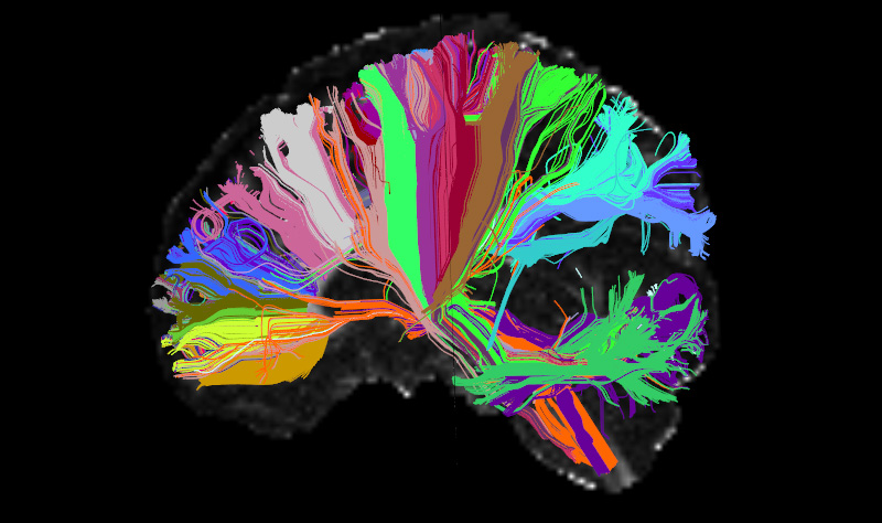 Long-distance connections in the human brain. Different colors indicate wiring associated with different brain structures.