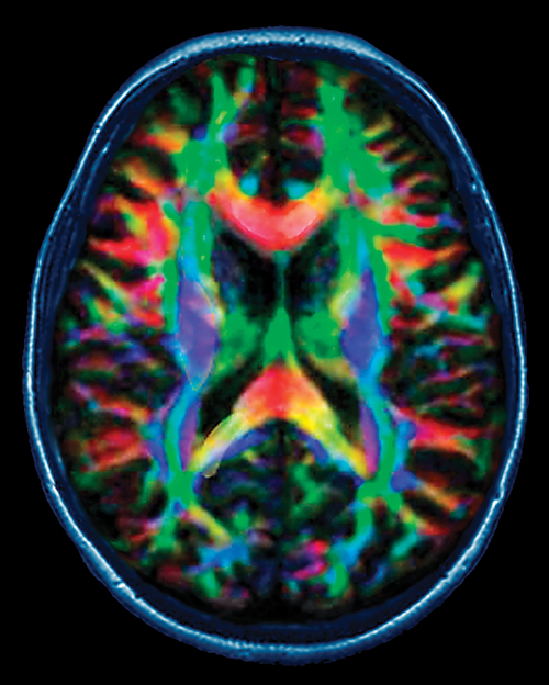 Studies of normative development offer a foundation for understanding abnormal processes. These studies, including a bone mineral density study that provides pediatric reference data, and a large-scale MRI study of children that defines normative structural brain development and neuropsychological data, provide the basis for exploring both typical and atypical physical and cognitive development.