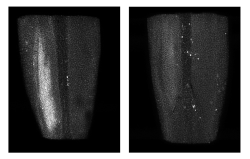 Damage to the spinal cord can develop hours to days after nerve injury. Normal mice (left) develop this damage (white patch), called microgliosis, while mice missing DLK (right) do not develop microgliosis.