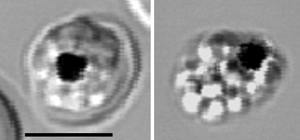 Normal parasites multiplying inside a red blood cell (left).