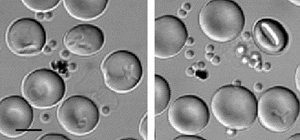 Parasite-infected red blood cells.