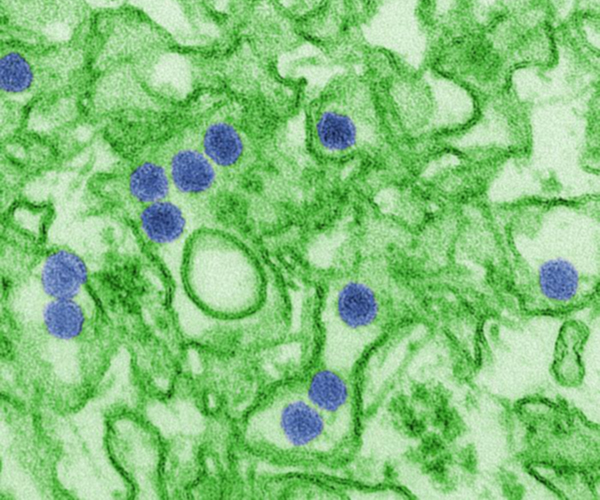 A digitally colorized microscopy image of Zika virus. The image shows blue dots against a green background. The blue dots are virus particles. 
