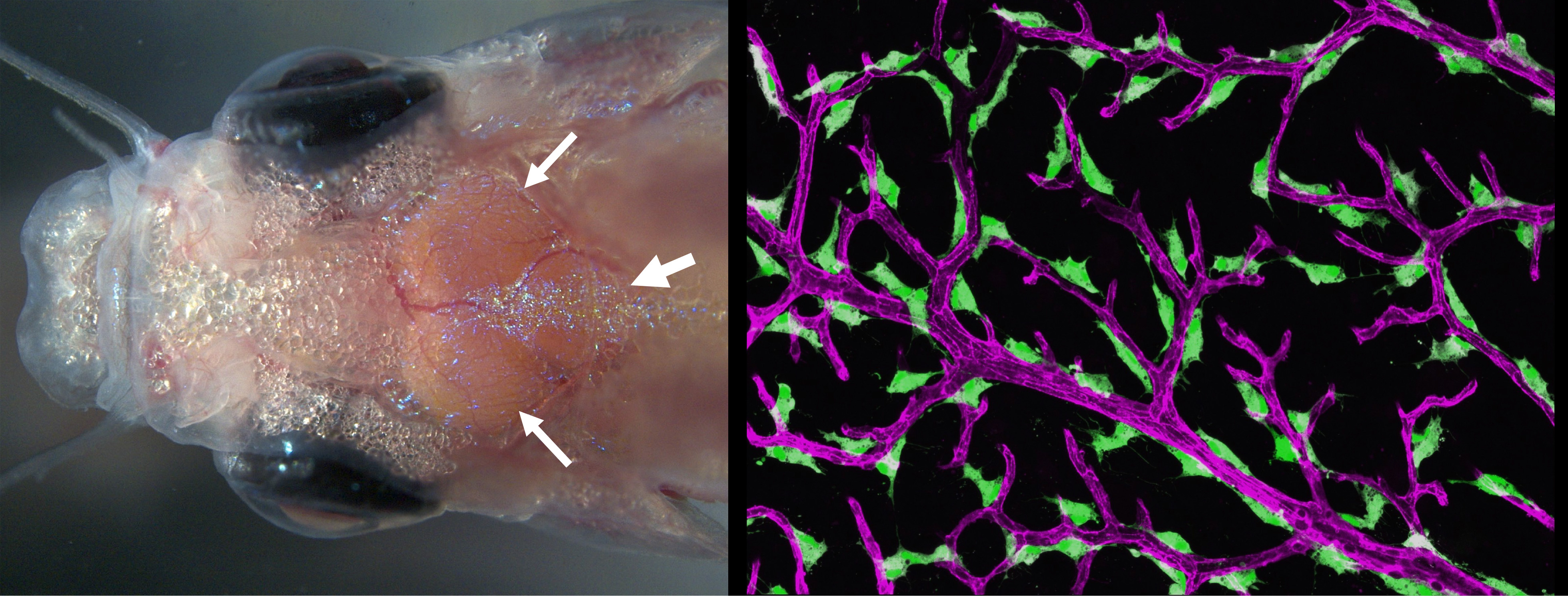 Adult zebrafish head and meningeal vessels