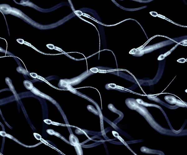 Microscopic image of sperm (white) moving against a black background.