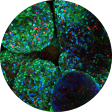 enzymes that post-translationally modify histones.