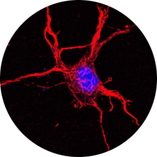 Diffusion tensor image of brain