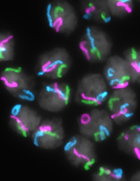 Eighteen cells are shown against a black background. The cells are gray spheres with the chromosomes shaped like thick squiggles inside the cell.