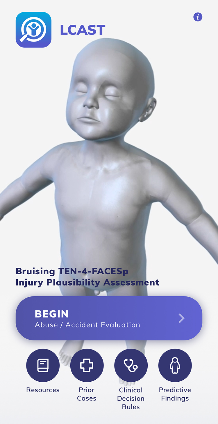 Screen containing a 3-D model of a young child. An icon showing a stick figure under a magnifying glass and the text “LCAST” appear in the top left. The text “Bruising TEN-4-FACESp Injury Plausibility Assessment” and a purple button labeled “Begin Abuse/Accident Evaluation” are overlaid on the model. Small icons and text at the bottom of the screen direct users to resources, prior cases, clinical decision rules, and predictive findings.
