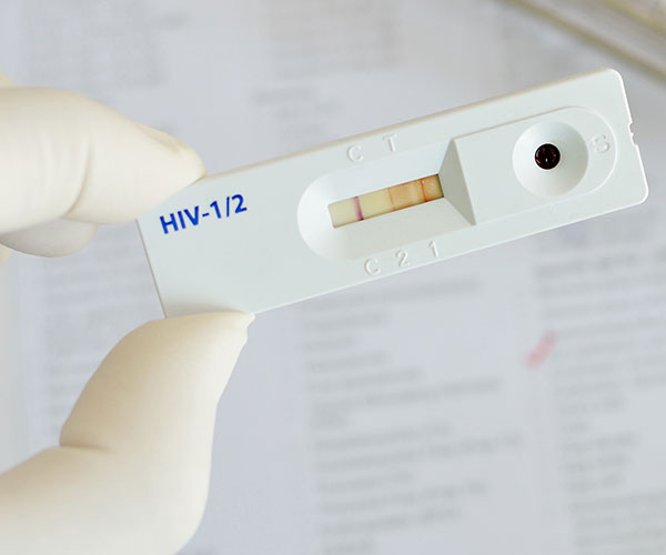 Gloved fingers hold an HIV rapid test.