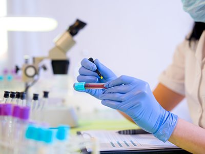 A scientist wearing a mask and gloves holds a vial of blood in a lab, empty vials and a microscope can be seen in the background.