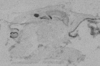 NeuroD1 E20.