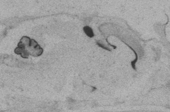 NeuroD1 P2.