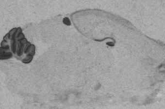 NeuroD1 P6.