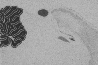 NeuroD1 P12.