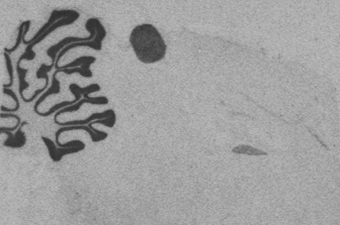 NeuroD1 P30.