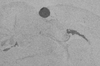 Otx2 P30.
