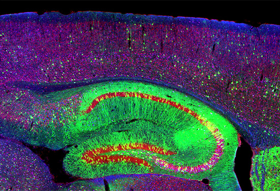 Microscopy image of a mouse brain with Niemann-Pick disease type C1. Credit: NICHD/NIH