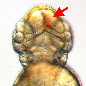 Dorsal view of the head of a 3 dpf "bloody mary" (rhoaa) mutant zebrafish with prominent intracranial hemorrhage (red arrow).