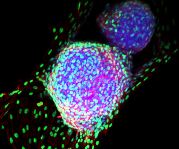 Bioprosthetic ovary created by NICHD-funded researchers, with oocytes (purple/blue) and follicles (green), to improve fertility in women with cancer. 