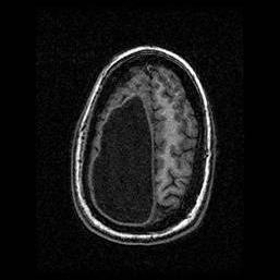 Axial view of MRI data.