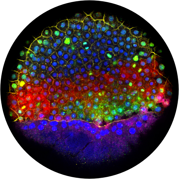 RNA in situ of zebrafish embryo.