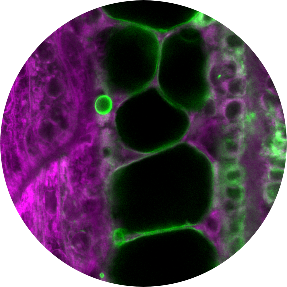 Differentiating cells in the notochord.