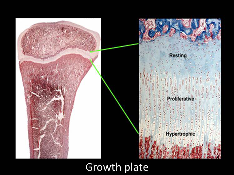 Growth plate showing the three layers: the resting, proliferative, and hypertrophic zones.