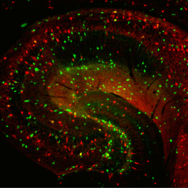 Hippocampus inhibitory synapses, illustrated by flecks of green and red.