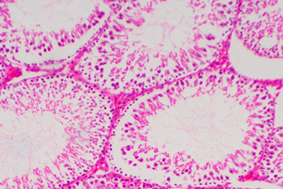 Human sperm in the testis morphology under microscope.