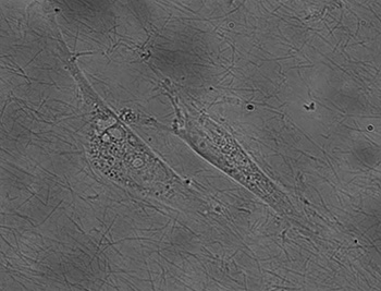 Morphology of endothelial cell seeding on an oriented collagen film