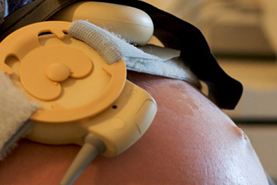 Sensors attached to a pregnant patient's abdomen in a medical exam room. 
