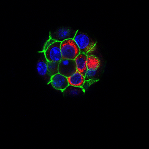 Microscopic view of endogeneous retrovirus.