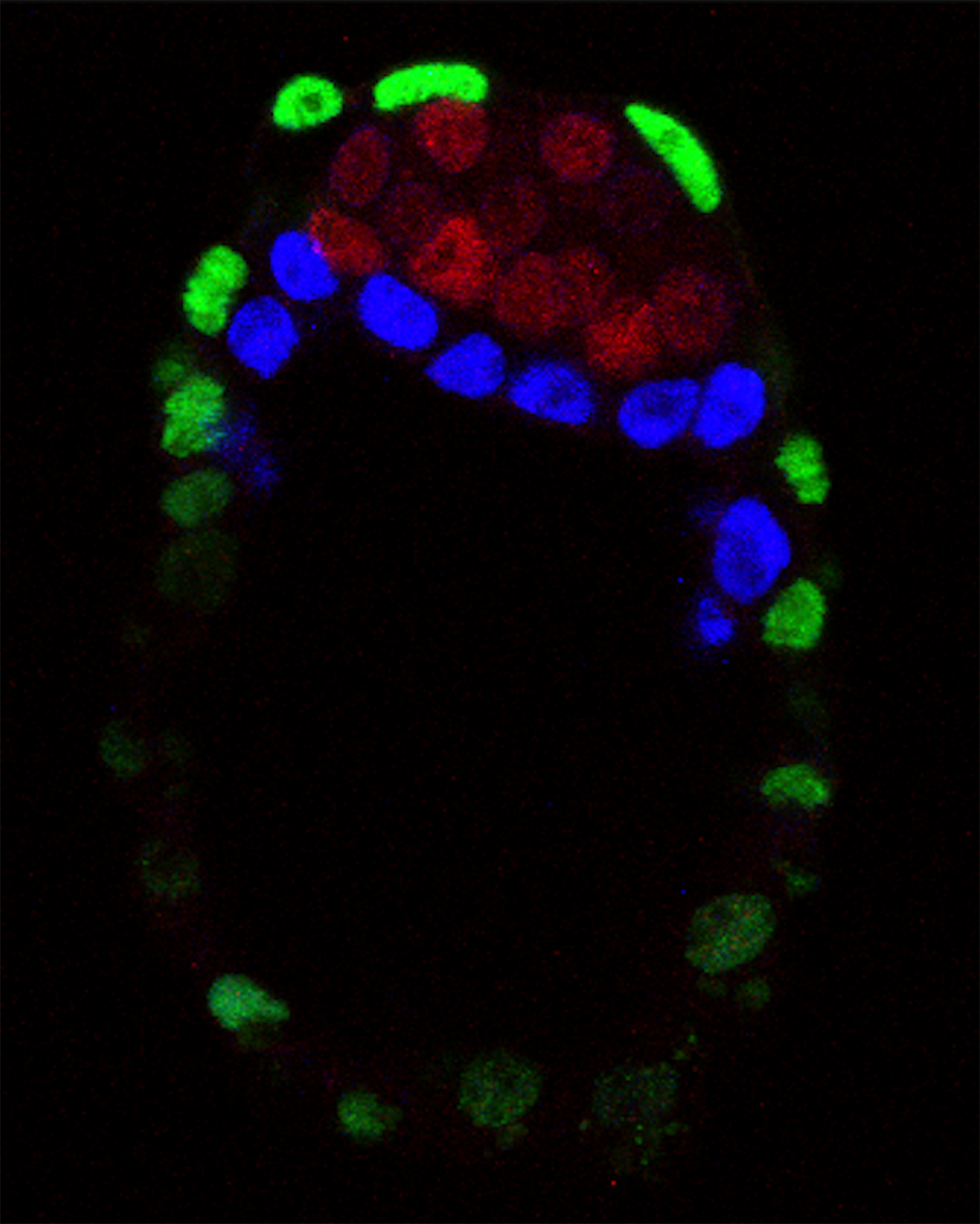 Photomicrograph of a mouse embryo.