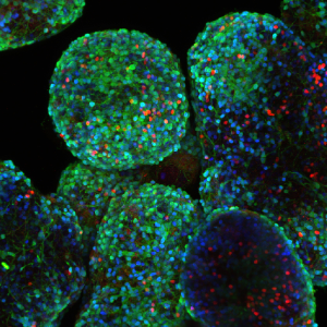 Enzymes that post-translationally modify histones/DNA.