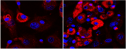 Mesenchymal Stem Cell Differentiation.