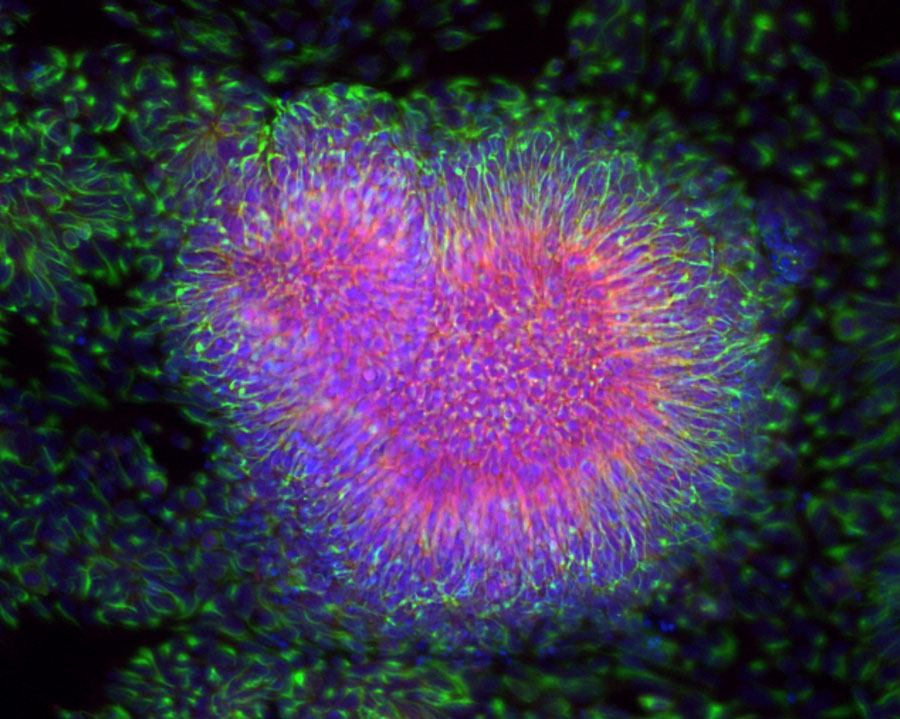 A micrograph of neural progenitor cells.